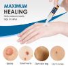 Skin Tag Remover,Wart Remover,Extra Strength Skin tag Removal,Tag Dry and Fall Away,Safe and Gentle,Suitable for All Skin Types
