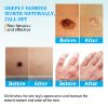 Skin Tag Remover, Warts & Mole Remover Cream, Fast-Acting & Effective Skin Tag Removal, Natural Formula, Safe and Painless, Easy to Apply