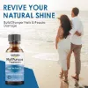 Senhorita Toenail Fungus Treatment, Nail Fungus Treatment for Toenail Fungus, Nail Treatment for Discolored and Damaged Nails