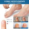 Senhorita Toenail Fungus Treatment, Nail Fungus Treatment for Toenail Fungus, Nail Treatment for Discolored and Damaged Nails