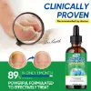 Ingrown Toenail Treatment, Professional & Safe & Efficient, for Paronychia Caused by Ingrown Toenail, 30ml