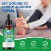 Ingrown Toenail Treatment, Professional & Safe & Efficient, for Paronychia Caused by Ingrown Toenail, 30ml