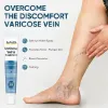 Varicose Veins Cream, Varicose Veins Treatment for Legs, Relief Spider Varicose Vein, Strengthen Capillary Health and Improve Blood Circulation