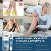 Varicose Veins Cream, Varicose Veins Treatment for Legs, Relief Spider Varicose Vein, Strengthen Capillary Health and Improve Blood Circulation