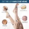 Varicose Veins Cream, Varicose Veins Treatment for Legs, Relief Spider Varicose Vein, Strengthen Capillary Health and Improve Blood Circulation