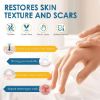 Picture of Scar Cream, Scar Mark Removal for C-Section, Stretch Marks, Acne, Surgery, Effective for Both Old and New Scars