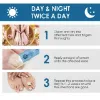 Toenail Fûngus Treatment, Toe Nail Repair Treatment Extra Strength, Effective Nail Repair Cream for Thick, Broken, Discolored Nails