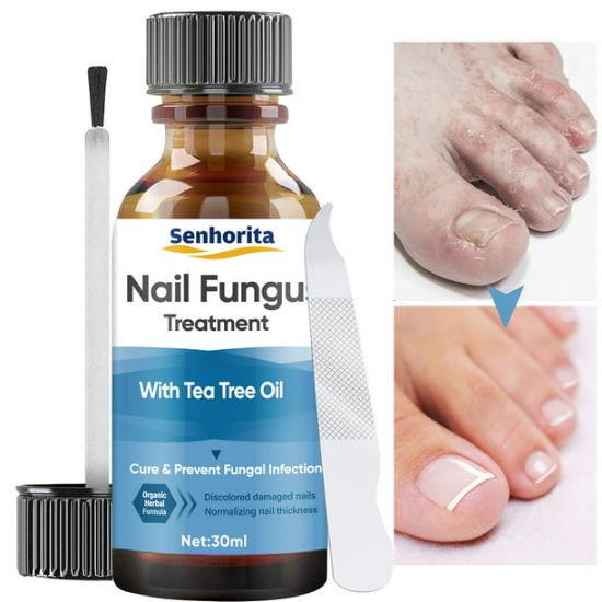 Picture of Toenail Fungus Treatment, Nail Fungus Treatment for Toenail Fungus, Nail Treatment for Discolored and Damaged Nails