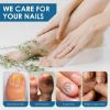 Picture of Toenail Fungus Treatment, Nail Fungus Treatment for Toenail Fungus, Nail Treatment for Discolored and Damaged Nails