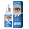 Picture of Stye Eye Treatment (30 ml)