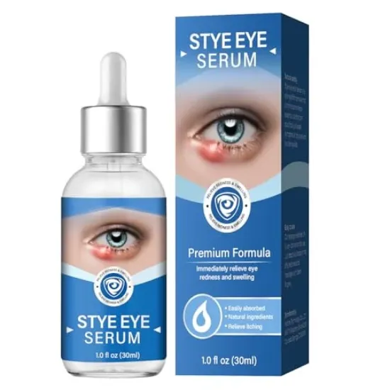 Picture of Stye Eye Treatment (30 ml)