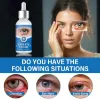 Picture of Stye Eye Treatment (30 ml)