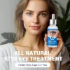 Picture of Stye Eye Treatment (30 ml)