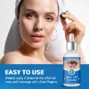 Picture of Stye Eye Treatment (30 ml)